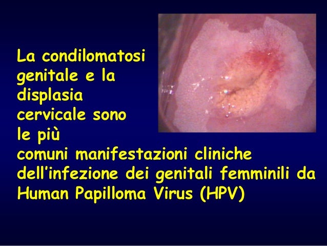 infezione hpv infezione hpv